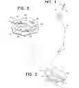 Fig. 02 - LOW PROFILE, MULTI PROBE, CRANIAL FIXATION DEVICE AND METHOD OF USE