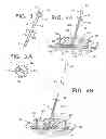 Fig. 03 - LOW PROFILE, MULTI PROBE, CRANIAL FIXATION DEVICE AND METHOD OF USE