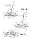 Fig. 04 - LOW PROFILE, MULTI PROBE, CRANIAL FIXATION DEVICE AND METHOD OF USE