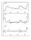 Fig. 43 - METHODS AND SYSTEMS FOR SELECTIVELY FILTERING A PHYSIOLOGICAL SIGNAL