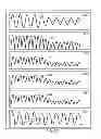 Fig. 49 - METHODS AND SYSTEMS FOR SELECTIVELY FILTERING A PHYSIOLOGICAL SIGNAL
