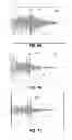 Fig. 43 - METHODS AND SYSTEMS FOR DETERMINING PHYSIOLOGICAL INFORMATION USING MODULATED SIGNALS