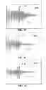 Fig. 43 - METHODS AND SYSTEMS FOR DETERMINING PHYSIOLOGICAL INFORMATION BASED ON FAST START PARAMETERS