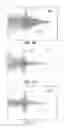 Fig. 43 - METHODS AND SYSTEMS FOR DETERMINING PHYSIOLOGICAL INFORMATION BASED ON A CROSS-CORRELATION WAVEFORM