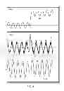 Fig. 41 - METHODS AND SYSTEMS FOR ADJUSTING A CRITERION FOR QUALIFYING A CALCULATED VALUE