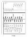 Fig. 41 - METHODS AND SYSTEMS FOR DETERMINING PHYSIOLOGICAL INFORMATION USING STATUS INDICATORS