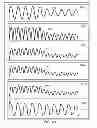 Fig. 49 - METHODS AND SYSTEMS FOR DETERMINING PHYSIOLOGICAL INFORMATION USING STATUS INDICATORS
