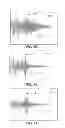 Fig. 43 - METHODS AND SYSTEMS FOR DETERMINING PHYSIOLOGICAL INFORMATION BASED ON A PEAK OF A CROSS-CORRELATION