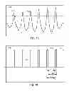 Fig. 45 - METHODS AND SYSTEMS FOR DETERMINING PHYSIOLOGICAL INFORMATION BASED ON A PEAK OF A CROSS-CORRELATION