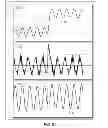 Fig. 41 - Methods and systems for determining an algorithm setting based on a difference signal
