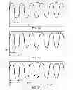 Fig. 79 - Methods and systems for determining an algorithm setting based on a difference signal