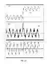 Fig. 41 - Methods and systems for determining an algorithm setting based on a difference signal