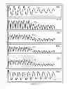Fig. 49 - Methods and systems for determining an algorithm setting based on a difference signal