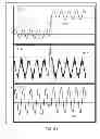Fig. 41 - METHODS AND SYSTEMS FOR DETERMINING NOISE INFORMATION FROM A PHYSIOLOGICAL SIGNAL