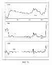 Fig. 43 - METHODS AND SYSTEMS FOR DETERMINING NOISE INFORMATION FROM A PHYSIOLOGICAL SIGNAL