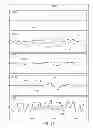 Fig. 47 - METHODS AND SYSTEMS FOR DETERMINING NOISE INFORMATION FROM A PHYSIOLOGICAL SIGNAL