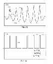 Fig. 45 - Methods and systems for qualifying physiological values based on metrics