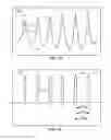 Fig. 45 - METHODS AND SYSTEMS FOR QUALIFYING PHYSIOLOGICAL VALUES BASED ON CROSS-CORRELATIONS