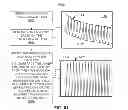 Fig. 40 - METHODS AND SYSTEMS FOR DETERMINING PHYSIOLOGICAL INFORMATION USING AUTOCORRELATION AND AN ENVELOPE TECHNIQUE