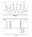 Fig. 45 - METHODS AND SYSTEMS FOR DETERMINING PHYSIOLOGICAL INFORMATION USING AUTOCORRELATION AND AN ENVELOPE TECHNIQUE