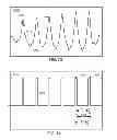 Fig. 45 - METHODS AND SYSTEMS FOR DETERMINING PHYSIOLOGICAL INFORMATION USING AUTOCORRELATION BASED ON A MODIFIED SIGNAL