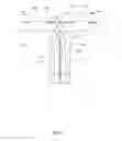 Fig. 07 - OPEN IRRIGATED-MAPPING LINEAR ABLATION CATHETER
