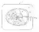Fig. 01 - Apparatus and method for energy distribution in a medical electrode