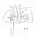 Fig. 07 - Passive acoustic driver for magnetic resonance elastography