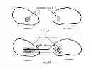 Fig. 07 - SYSTEM AND METHOD FOR IMAGE GUIDED MEDICAL PROCEDURES