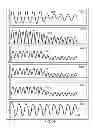 Fig. 49 - METHODS AND SYSTEMS FOR CONDITIONING A PHYSIOLOGICAL SIGNAL USING AN ADJUSTABLE BANDPASS FILTER