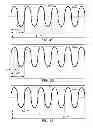 Fig. 31 - METHODS AND SYSTEMS FOR DETERMINING PHYSIOLOGICAL INFORMATION BASED ON THE SHAPE OF AUTOCORRELATION PEAKS