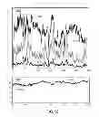 Fig. 32 - METHODS AND SYSTEMS FOR DETERMINING PHYSIOLOGICAL INFORMATION BASED ON THE SHAPE OF AUTOCORRELATION PEAKS