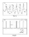 Fig. 45 - METHODS AND SYSTEMS FOR DETERMINING PHYSIOLOGICAL INFORMATION BASED ON THE SHAPE OF AUTOCORRELATION PEAKS