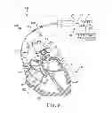 Fig. 09 - Methods and systems for recharging an implanted device by delivering a section of a charging device adjacent the implanted device within a body