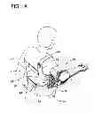 Fig. 02 - Shoulder orthosis including flexion/extension device