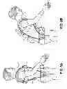 Fig. 06 - Posture and Lifting Orthotic