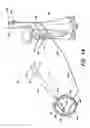 Fig. 06 - Vibrating surgical device for removal of vitreous and other tissue