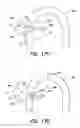 Fig. 09 - Vibrating surgical device for removal of vitreous and other tissue