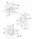 Fig. 06 - Bladeless optical obturator