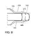 Fig. 07 - Soft tip balloon catheter
