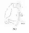 Fig. 02 - Visual inflation/deflation indicator for a balloon catheter