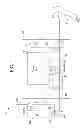 Fig. 02 - Intravenous pumping air management systems and methods
