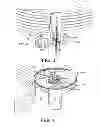 Fig. 03 - Insulin infusion set