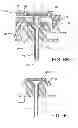 Fig. 05 - Insulin infusion set