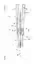Fig. 03 - Catheter assembly
