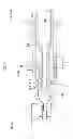 Fig. 05 - Catheter assembly