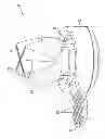 Fig. 01 - Cannula seal