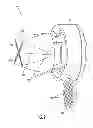 Fig. 03 - Cannula seal