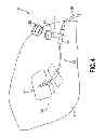 Fig. 05 - Adapter cap for drug transfer assembly