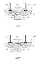 Fig. 11 - Needle hub and valve for needle hub